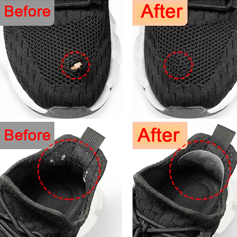 Патчи для спортивной обуви, ре – обзор и цена Sneaker Care Kit